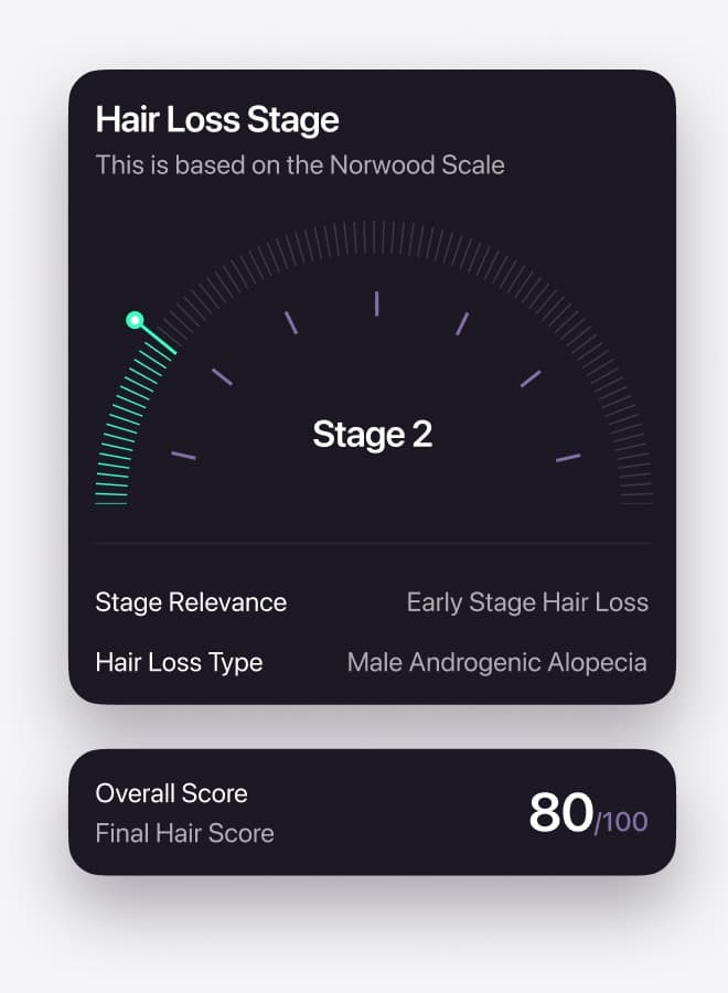 Norwood Scale Analysis